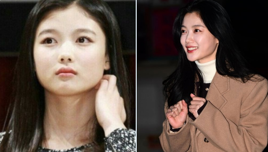 kim yoo jung-thumbnail